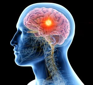 imagem mostrando cérebro com dor de cabeça