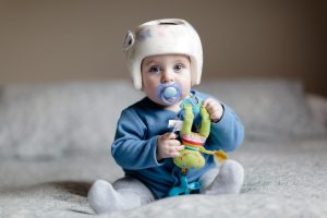 criança usando capacete após cirurgia de cranioestenose