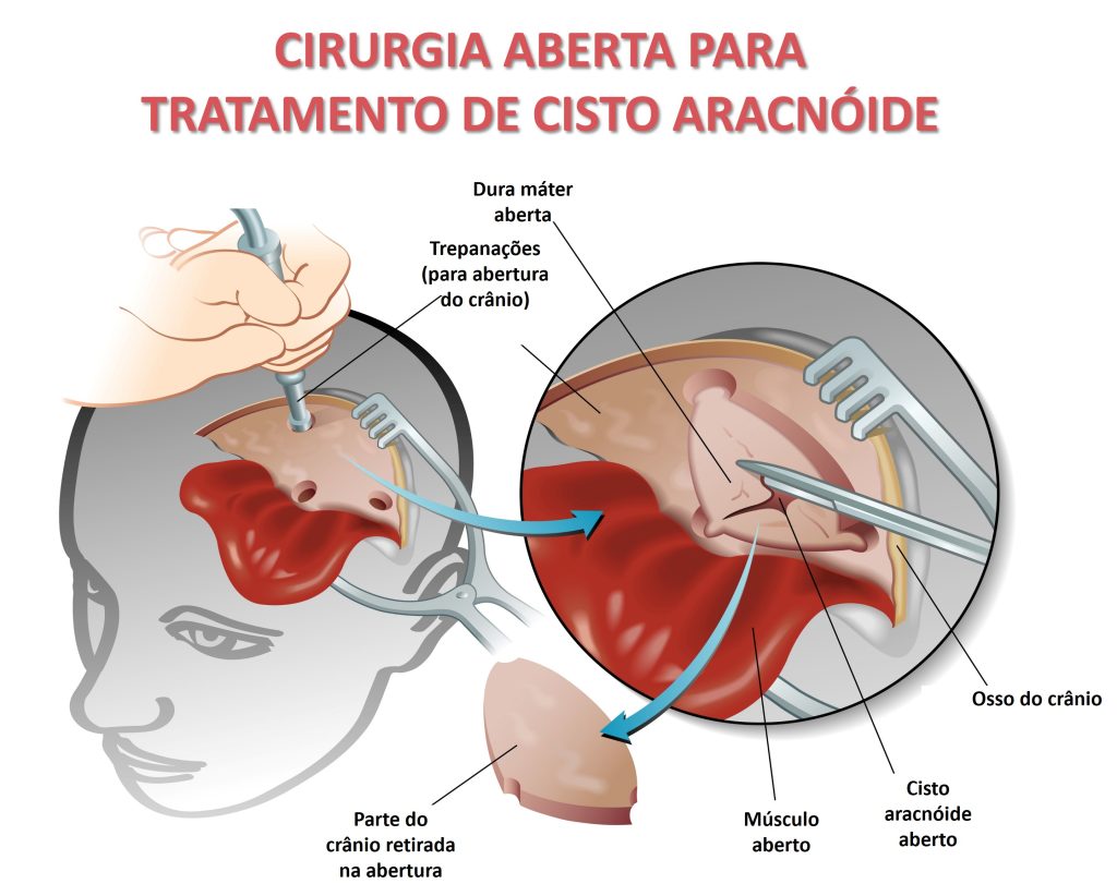 Knifemaking Knife Blade SM-APR-BL18 DAMASCUS