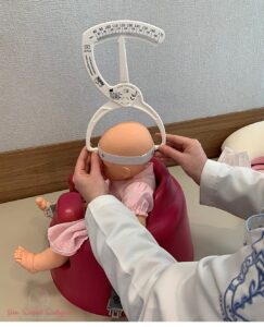 médica medindo crânio do bebê com um craniômetro para classificar e quantificar a assimetria craniana posicional