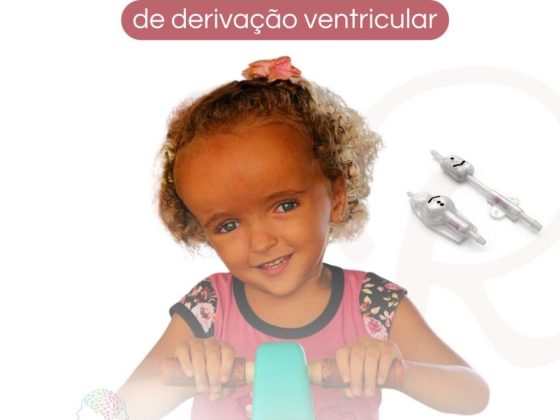 Arquivo De Hidrocefalia Dra Raquel Rodrigues Neurocirurgia Pediátrica 8311
