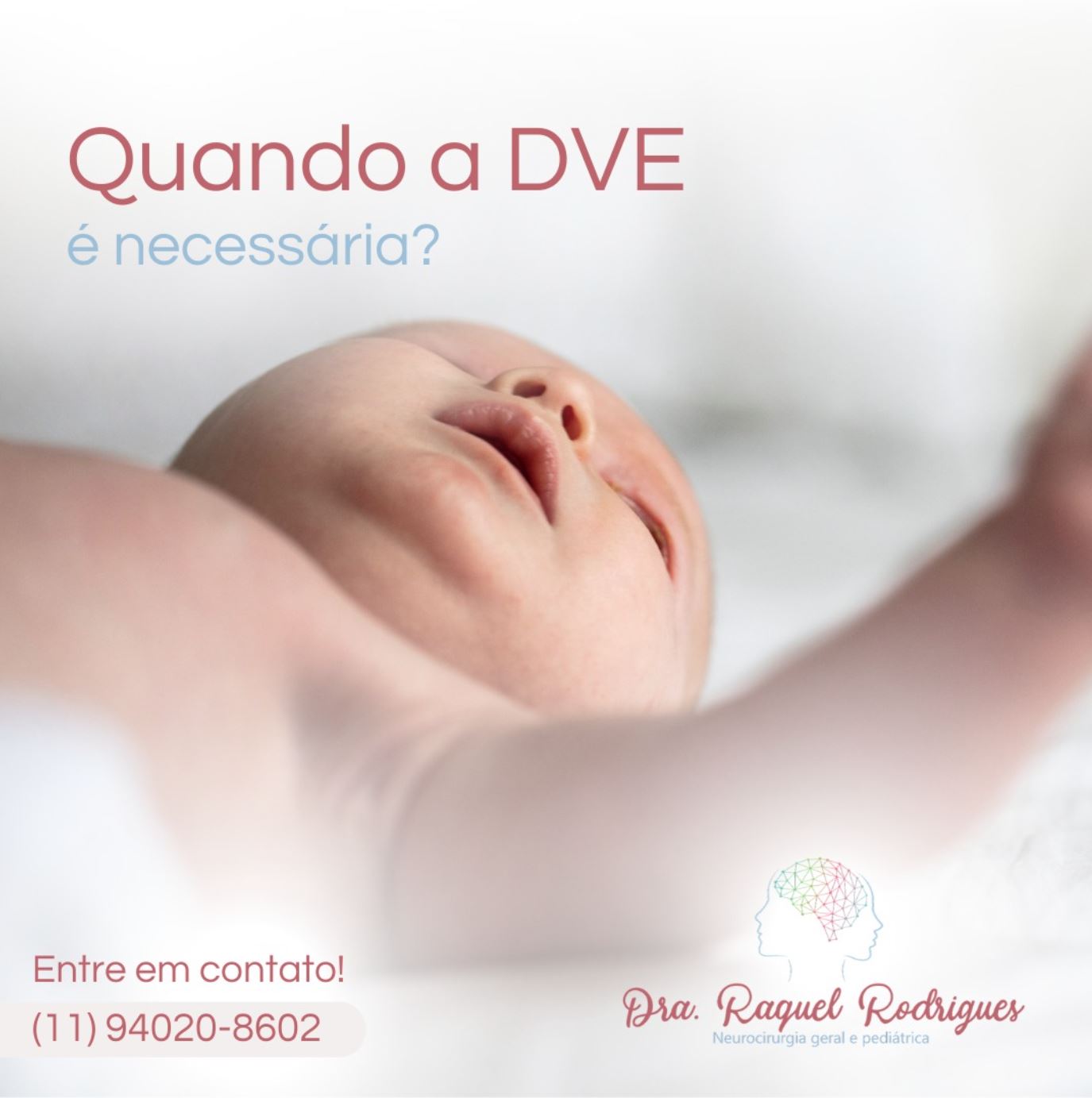 Quando a derivação ventricular externa (DVE) é necessária? - Dra ...