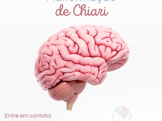 o que é a malformação de chiari