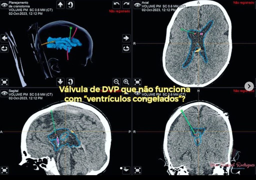 como saber se uma dvp funciona