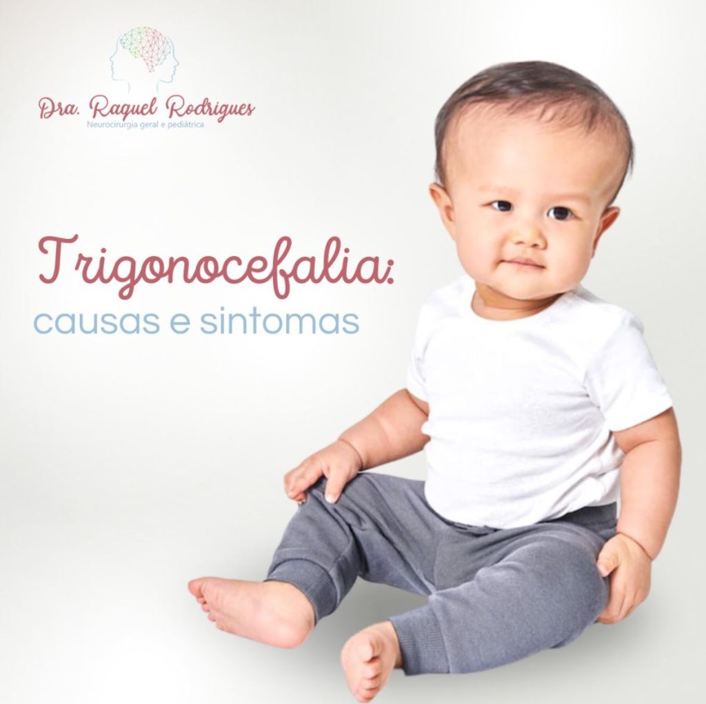 Trigonocefalia - causas e sintomas - Dra. Raquel Rodrigues ...